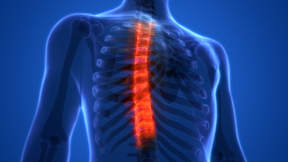 Bizkarrezurreko torakoaren osteochondrosia