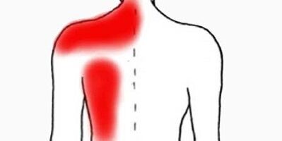 bizkarretik ezkerreko omoplatoaren azpian mina