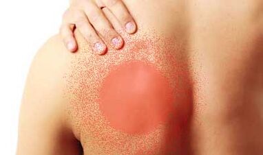 mina ezkerreko omoplatoaren azpian